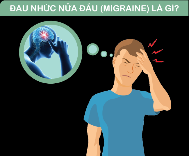 MIGRAINE (BỆNH ĐAU NỬA ĐẦU)